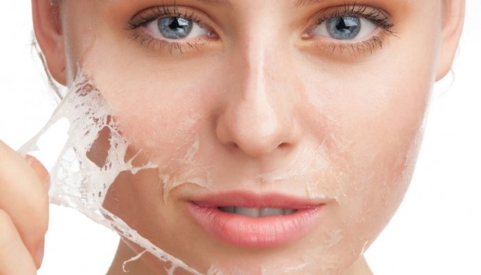 Peelings peeling4.jpg